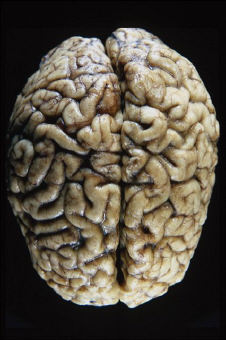 brain